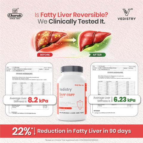 Vedistry Liver Care Tablets for Fatty Liver